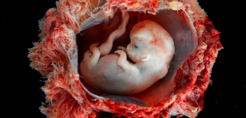 Aber was ist mit einer Eileiterschwangerschaft?