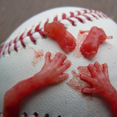 Abgetriebenes Kind, 12 Wochen