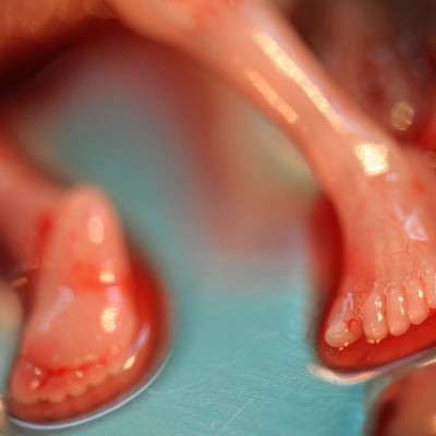 Abgetriebenes Kind, 15 Wochen