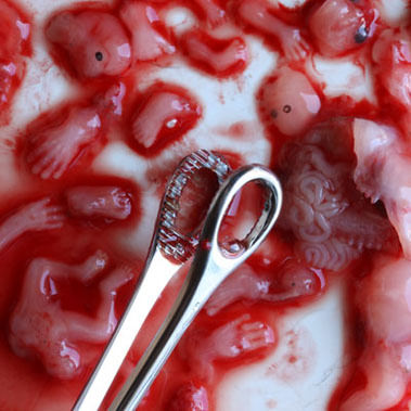 Abgetriebenes Kind, 6-13 Wochen