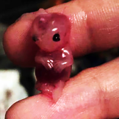 Abgetriebenes Kind, 7 Wochen