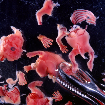 Abgetriebenes Kind, 8 Wochen